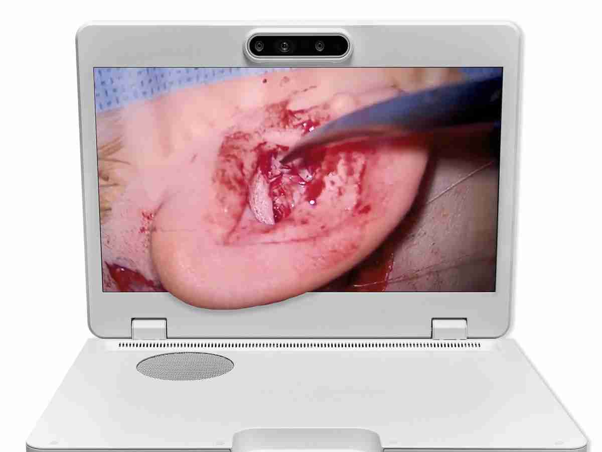 达擎之＂Heads-up 3D显微手术显示系统＂，，，整合4K裸眼3D显示及眼球追踪系统，，，具备快速追踪人眼移动位置功能，，，减轻医师长时间维持固定姿势的负担，，，，让医师能有更宽广清晰的3D立体视野及更舒适的姿势来执行手术。。